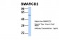SMARCD2 antibody - middle region